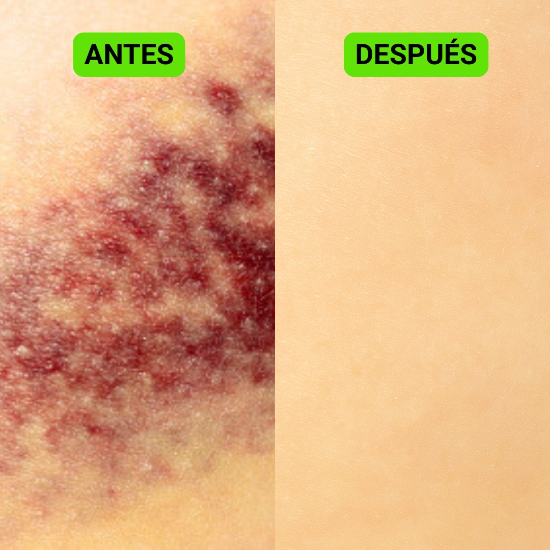 ANTES